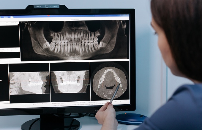 Así afecta el estrés por trabajo a la salud bucodental